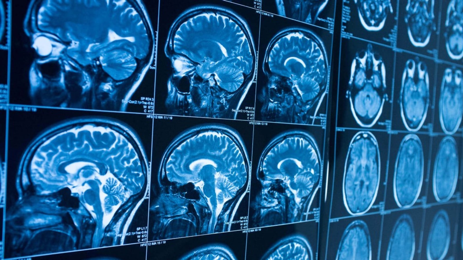 Examens d'imagerie médicale affichés sur écrans de radiologie Simago